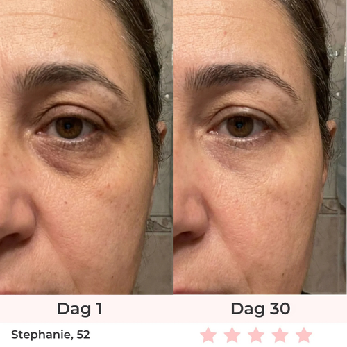 Pure Lune 7-in-1 LED Gezichtslifter