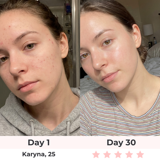 Pure Lune Collageenmasker